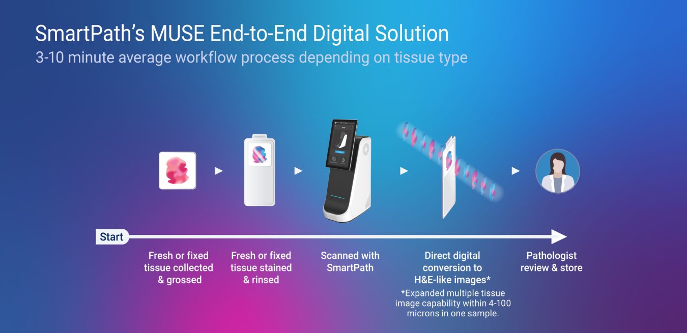 SP-Workflow